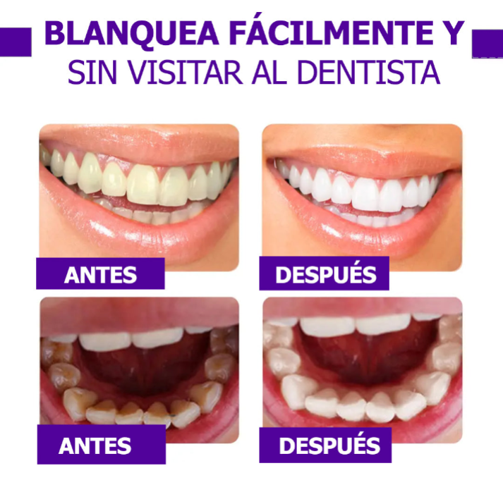 Blanqueador Dental - Sérum V34™