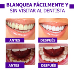 Blanqueador Dental - Sérum V34™