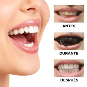 BLANQUEADOR DE DIENTES CON CARBÓN ACTIVO Y EXTRACTOS DE PLANTAS - WHITETH™