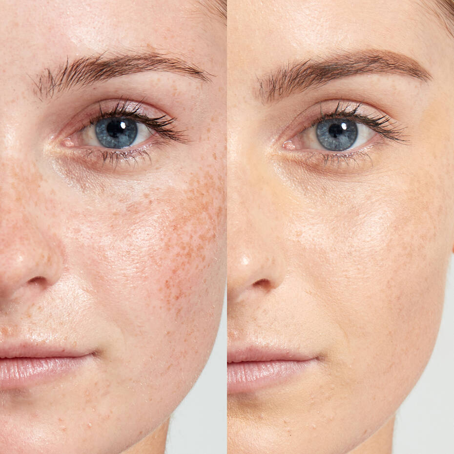 FLUS+™ - Conjunto de 6 Correctores Líquidos